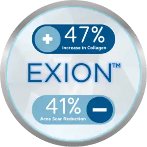 Exion 1
